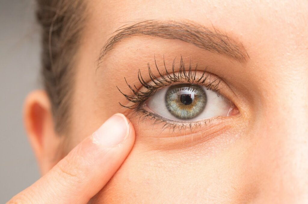 Close-up of an eye with a person gently pressing on the lower eyelid.