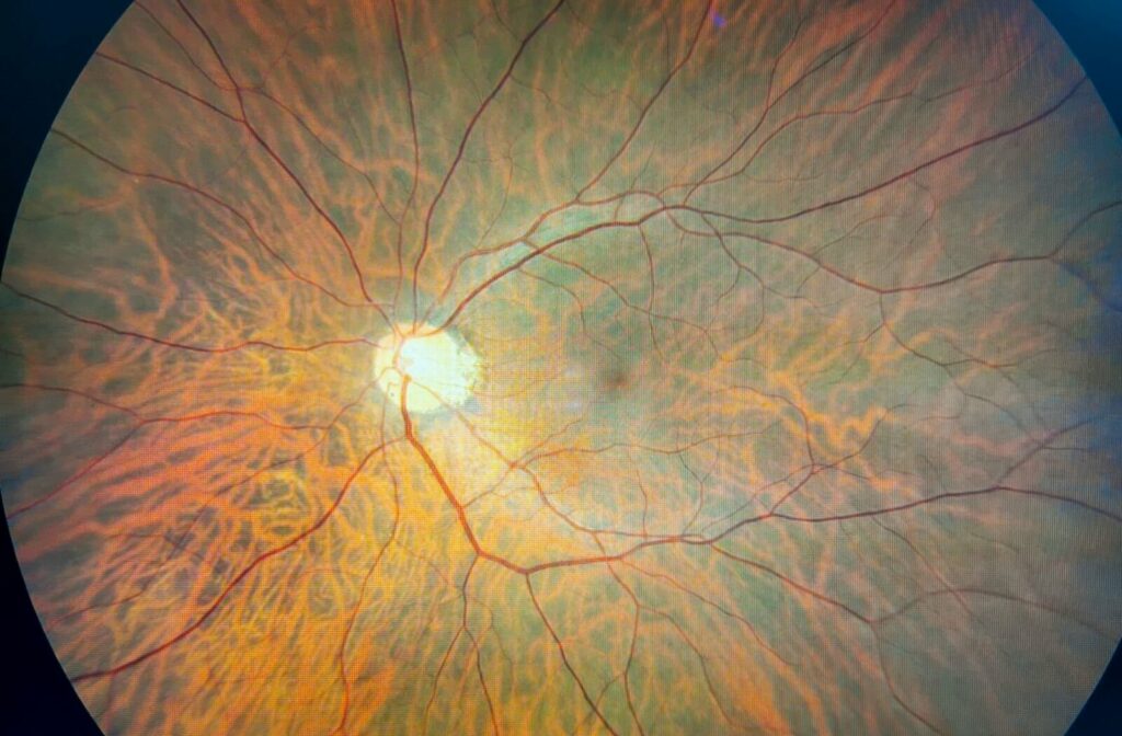 A close-up image of a retinal scan.