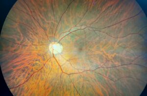 A close-up image of a retinal scan.