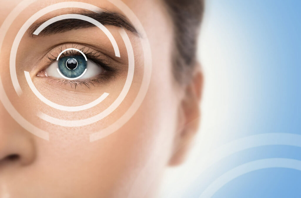 Close-up of eye with laser circles showing LASIK vision correction.