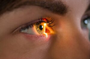 Retinal imaging showing detailed view of the eye.